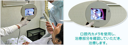 口腔内カメラを使用し、 治療部分を確認していただき、 治療します。